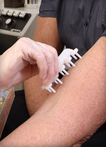Photo_allergy_testing1